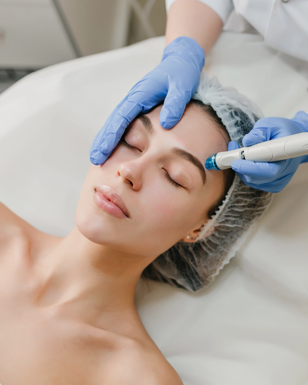 Hydro dermabrasion